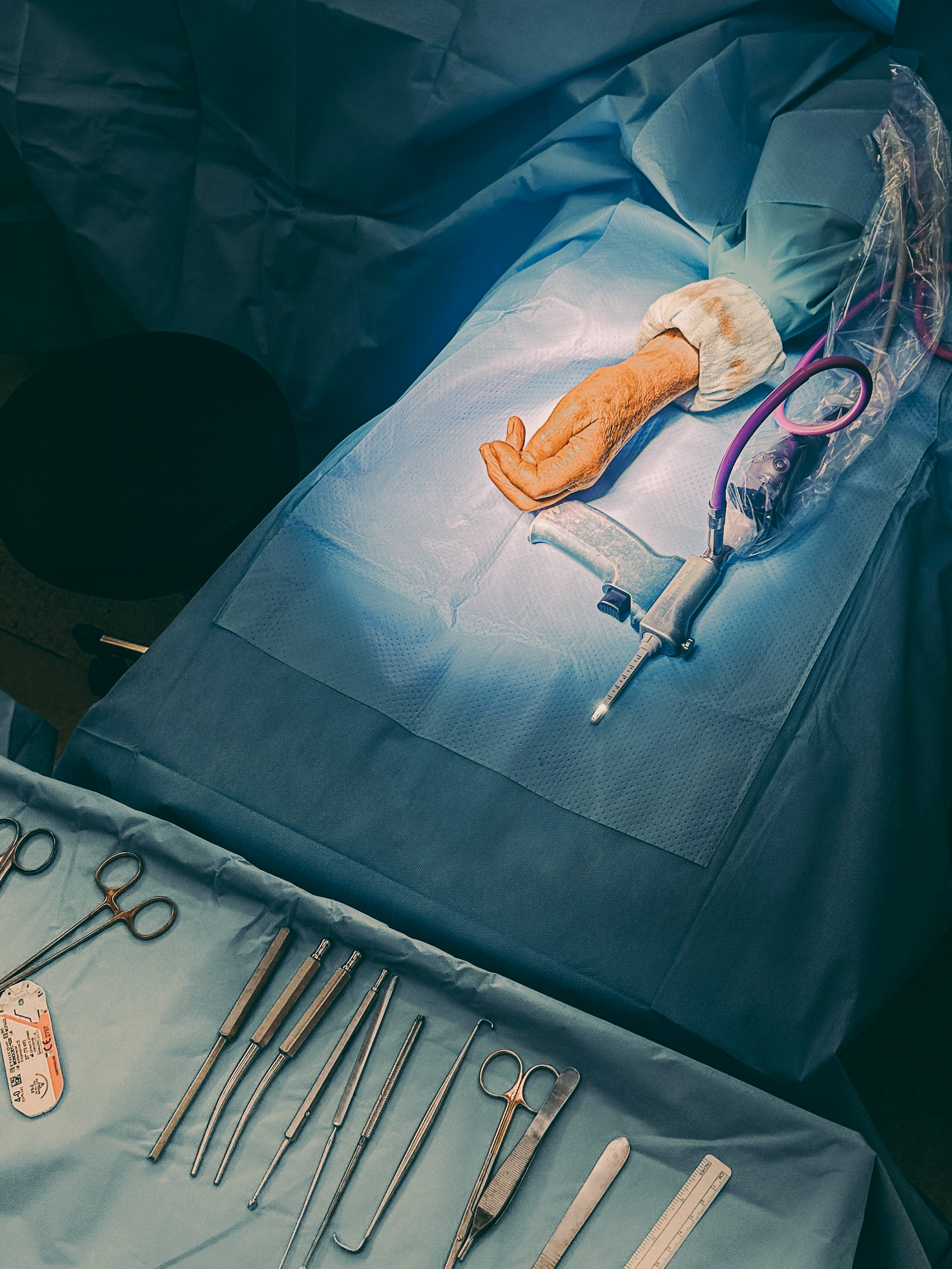 3 months in a surgery room.